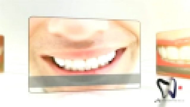 //Aurora Dental d.o.o.// Pomo&#269; pacientom pri implantatih Gnil zob Zobna kirurgija Zobna prev... 
